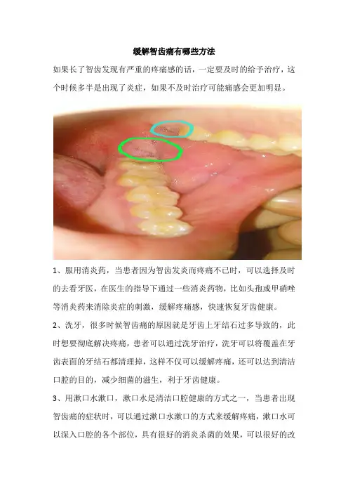 缓解智齿痛有哪些方法