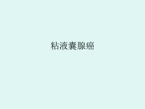 粘液囊腺癌