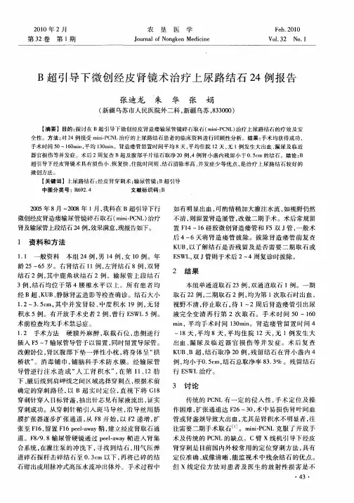B超引导下微创经皮肾镜术治疗上尿路结石24例报告