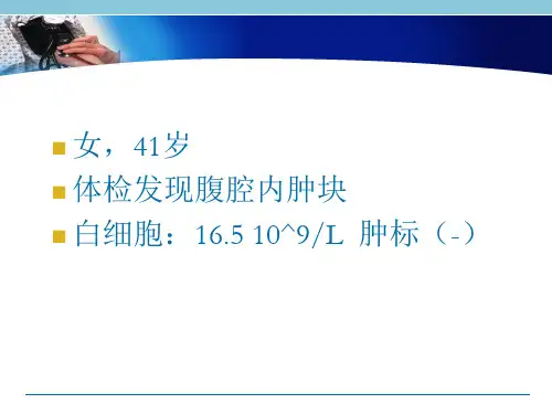 腹腔淋巴组织增生性病变CD(Castleman病)影像诊断与鉴别