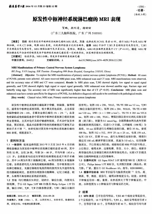 原发性中枢神经系统淋巴瘤的MRI表现