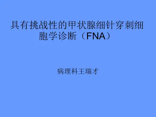 具有挑战性甲状腺细针穿刺细胞学诊断(FNA)TBS术语解读摘要