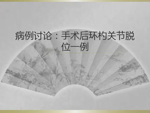 闫--环杓脱位