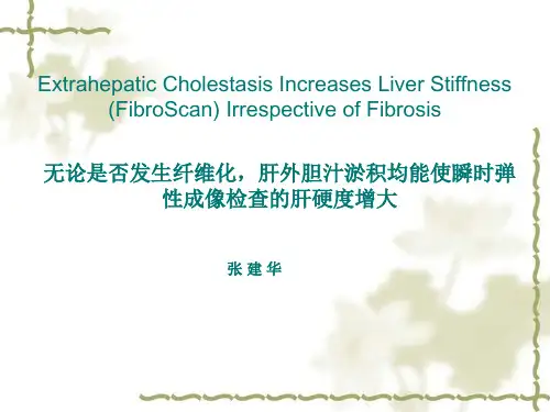 FibroScan