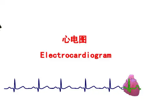 心电图培训研究培训课件