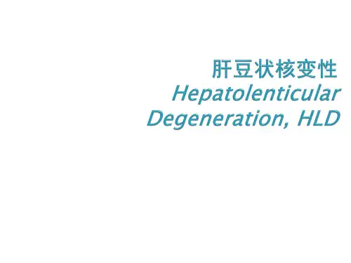 肝豆状核变性ppt演示课件