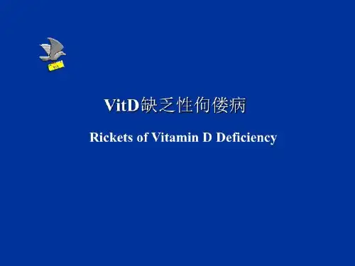 VitD缺乏性佝偻病医学课件