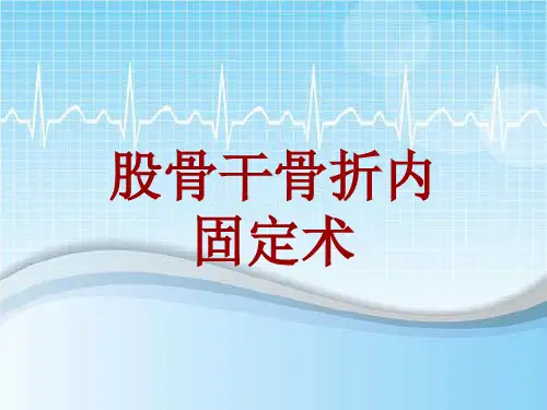 手术讲解模板：股骨干骨折内固定术