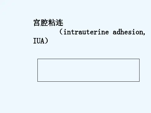 宫腔粘连 PPT