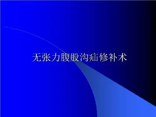 无张力腹股沟疝修补术 ppt课件
