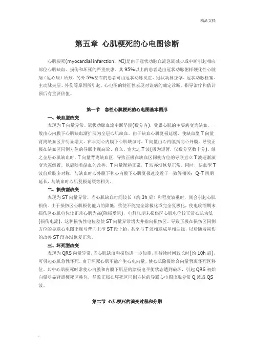 第五章 心肌梗死的心电图诊断