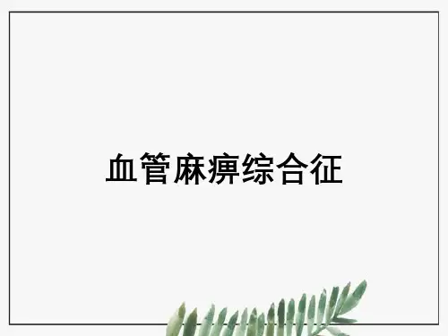 血管麻痹综合征