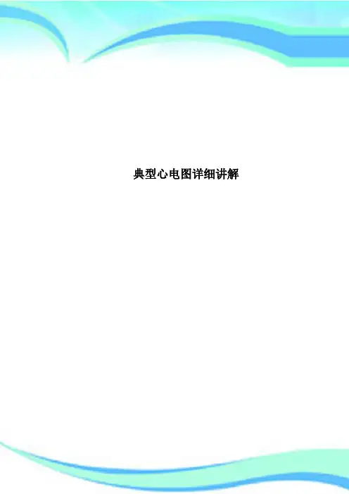 典型心电图详细讲解