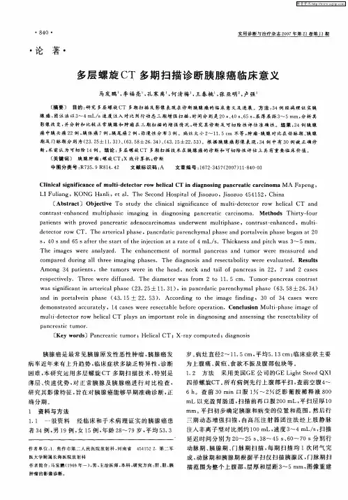 多层螺旋CT多期扫描诊断胰腺癌临床意义