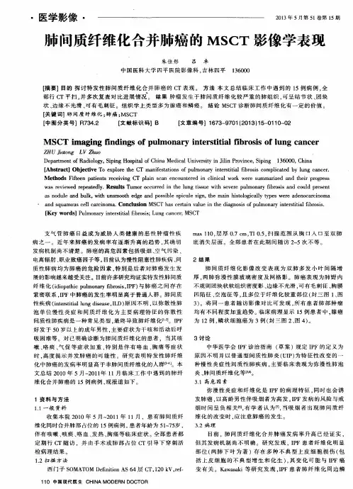 肺问质纤维化合并肺癌的MSCT影像学表现