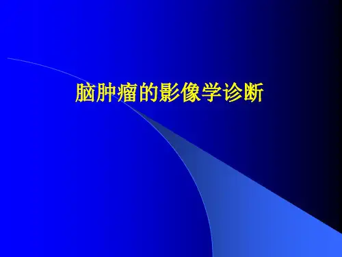 脑肿瘤的影像诊断精品PPT课件