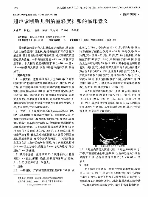 超声诊断胎儿侧脑室轻度扩张的临床意义