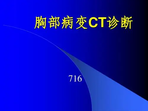 胸部病变CT诊断2001