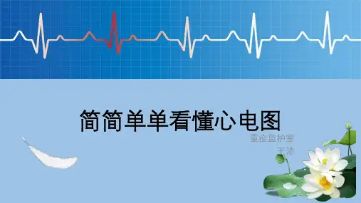 教你看懂心电图ppt课件