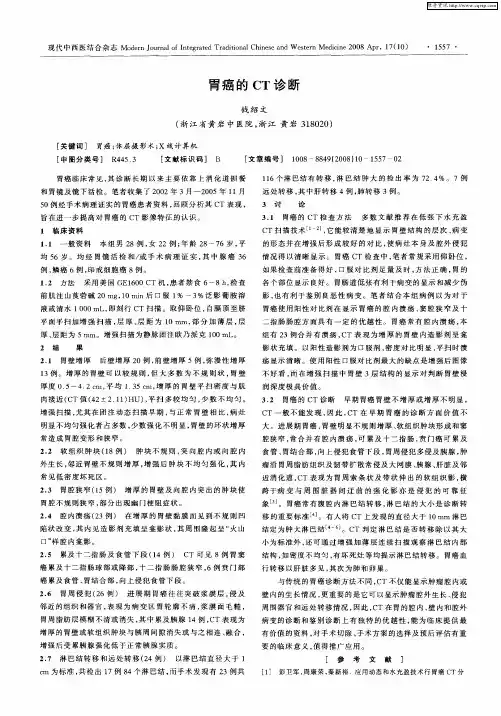 胃癌的CT诊断