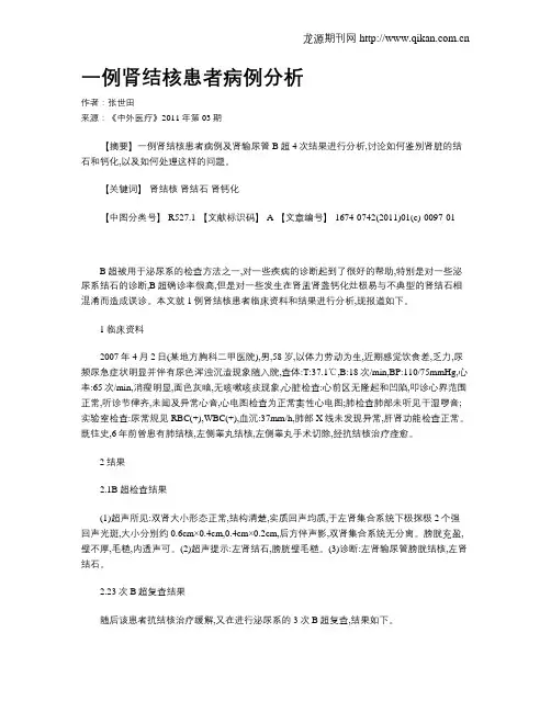 一例肾结核患者病例分析