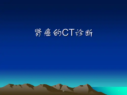 肾癌的CT诊断