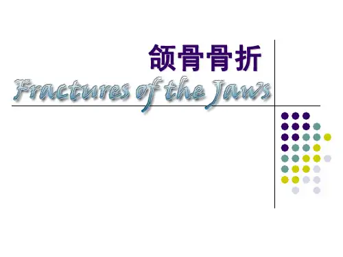 口腔颌面外科_颌骨骨折