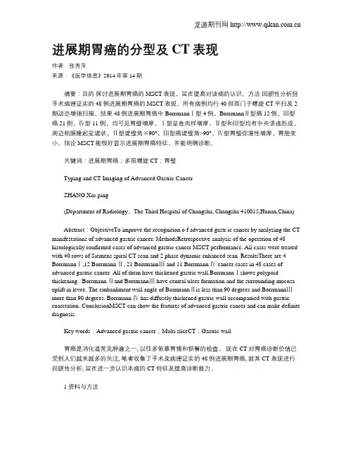 进展期胃癌的分型及CT表现