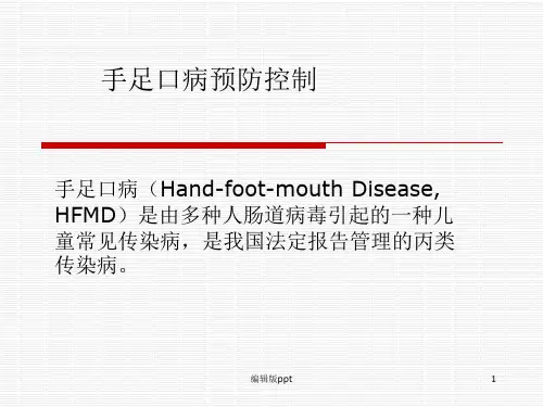 手足口病的宣传课件PPT