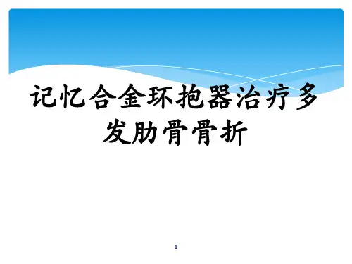 肋骨骨折内固定术参考课件