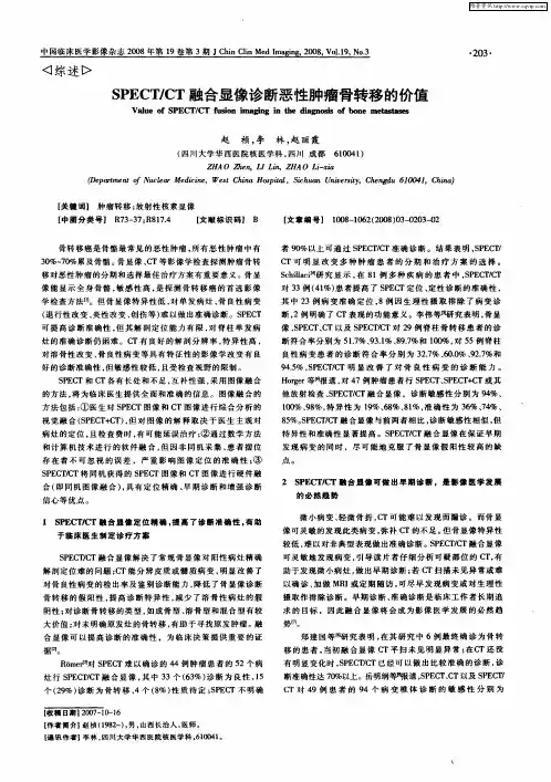 SPECT／CT融合显像诊断恶性肿瘤骨转移的价值