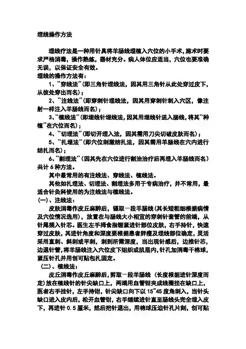 埋线操作方法