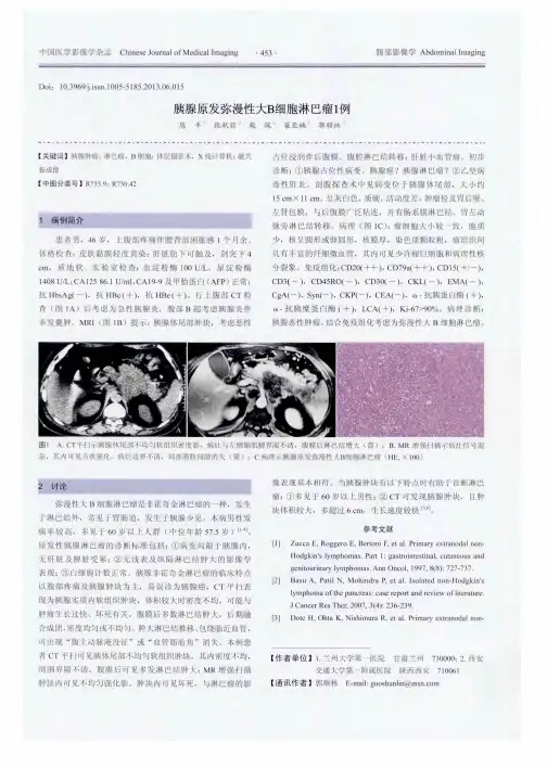 胰腺原发弥漫性大B细胞淋巴瘤1例