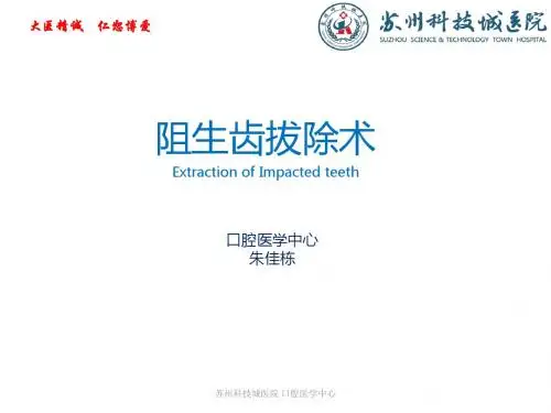 阻生齿拔除术