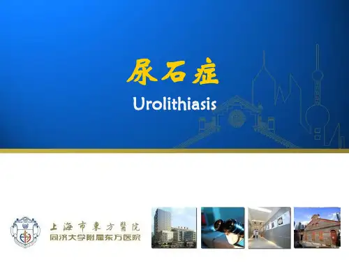 泌尿PPT课件：尿石症
