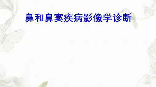 鼻和鼻窦疾病影像学诊断ppt课件