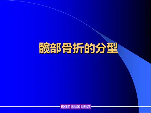 髋部骨折的分型精品PPT课件