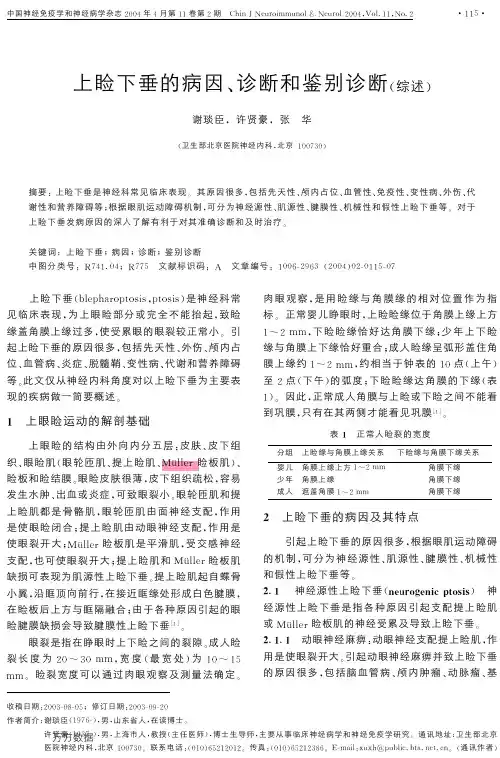 上睑下垂的病因、诊断和鉴别诊断(综述).aspx