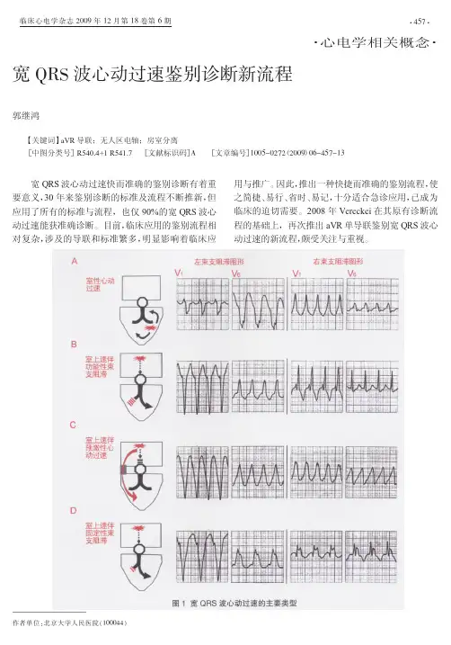 宽QRS波心动过速鉴别诊断新流程