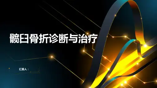 髋臼骨折诊断与治疗PPT
