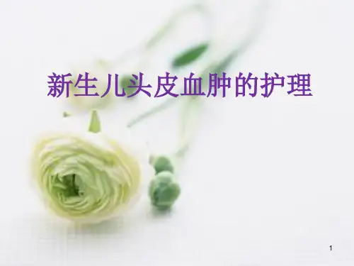 新生儿头皮血肿的护理PPT课件