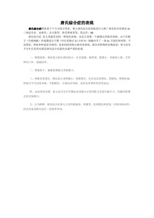 唐氏综合症的表现
