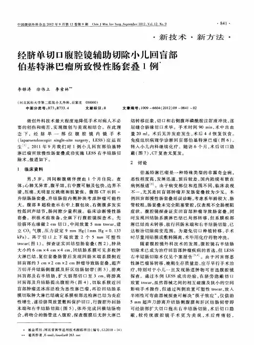 经脐单切口腹腔镜辅助切除小儿回盲部伯基特淋巴瘤所致慢性肠套叠1例