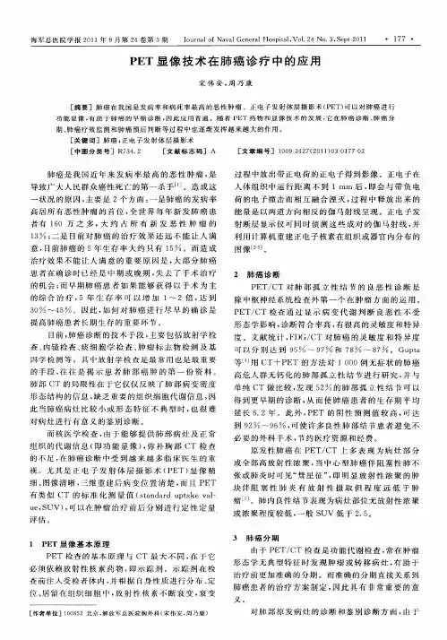 PET显像技术在肺癌诊疗中的应用