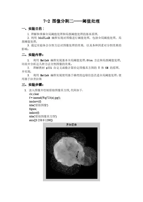 图像分割二——阈值处理