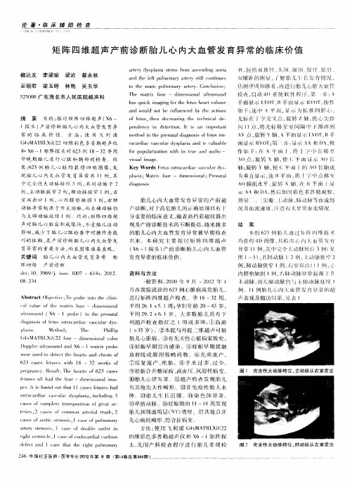 矩阵四维超声产前诊断胎儿心内大血管发育异常的临床价值