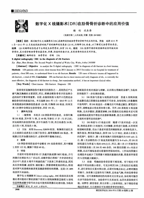 数字化X线摄影术(DR)在肋骨骨折诊断中的应用价值