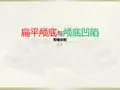 扁平颅底与颅底凹陷影像诊断