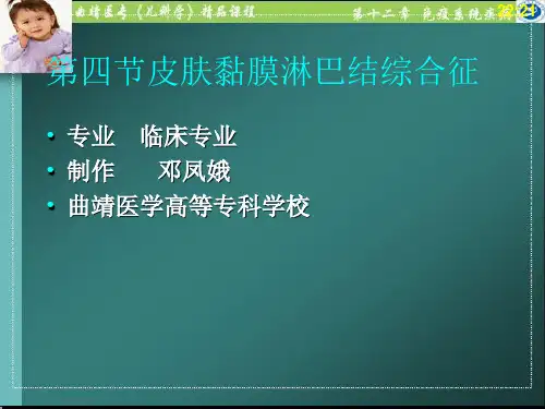 医学资料皮肤黏膜淋巴结综合征课件
