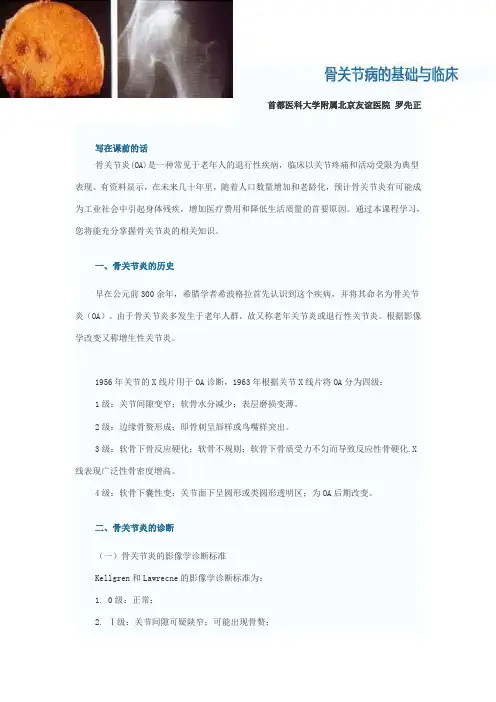 骨关节病及其治疗现状